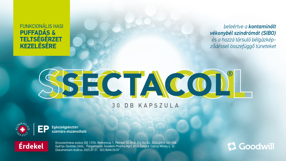 Sectacol bannerek-12-1000x563