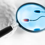 Spermavizsgálat – férfi termékenység